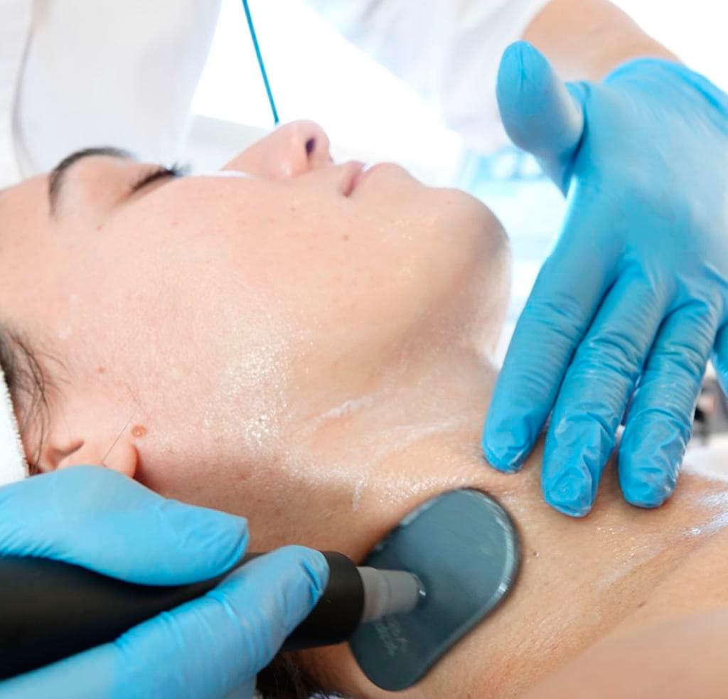 Beneficios radiofrecuencia INDIBA