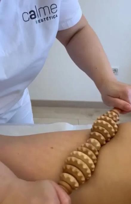 Maderoterapia - Imagen 1