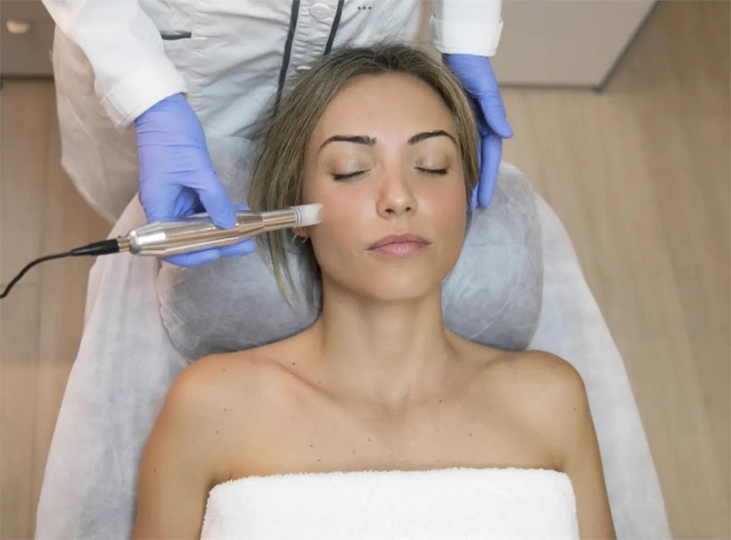 Microneedling